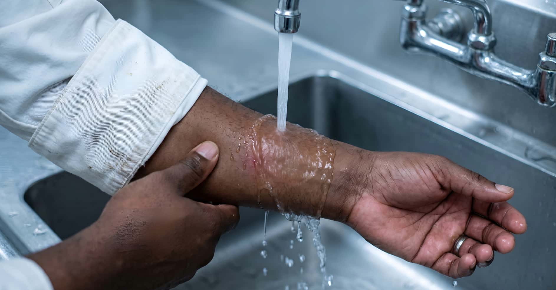 First Aid for Chemical Burns: What to Do