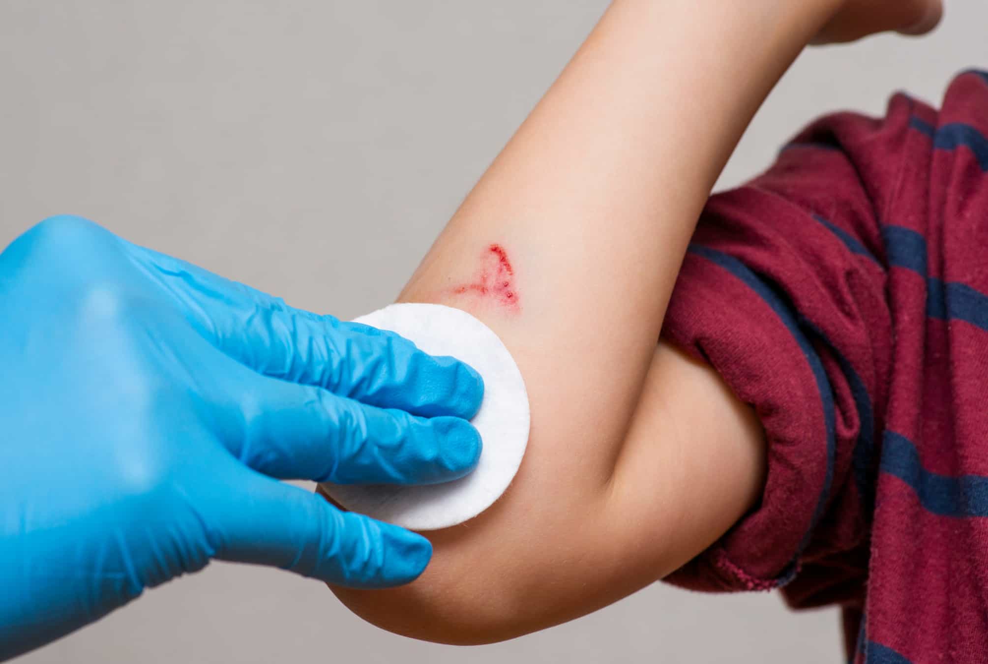 Cleaning a minor cut with a sterile wipe as part of basic first aid for small wounds.