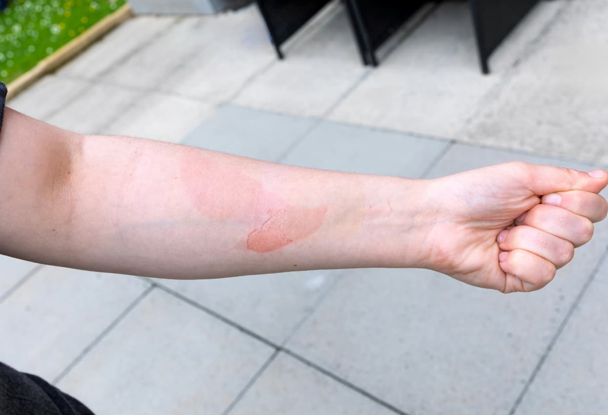 No First Aid Kit UK Guide